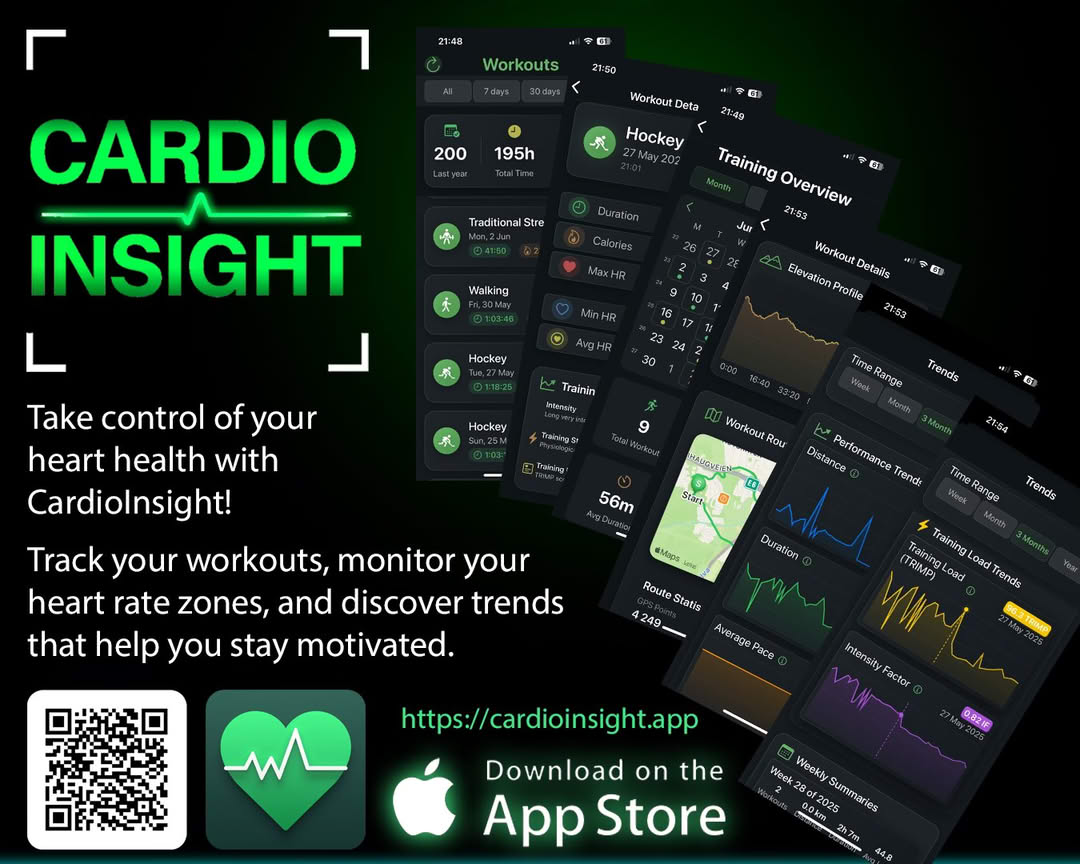 CardioInsight